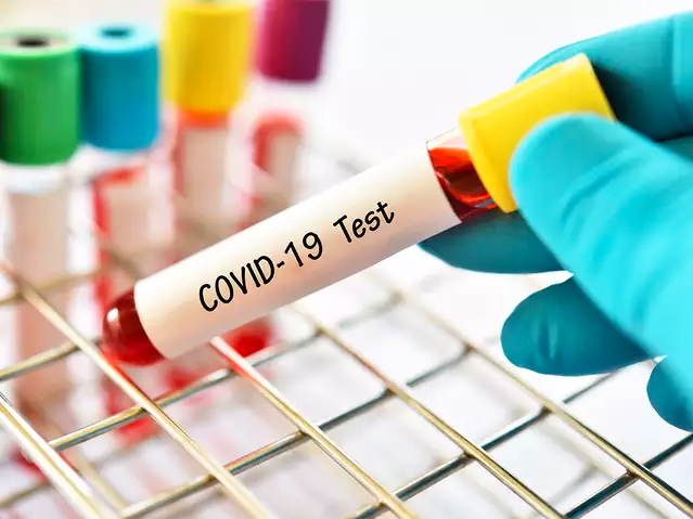 Ministrul sanatatii anunta testarea in masa anti-coronavirus a populatiei